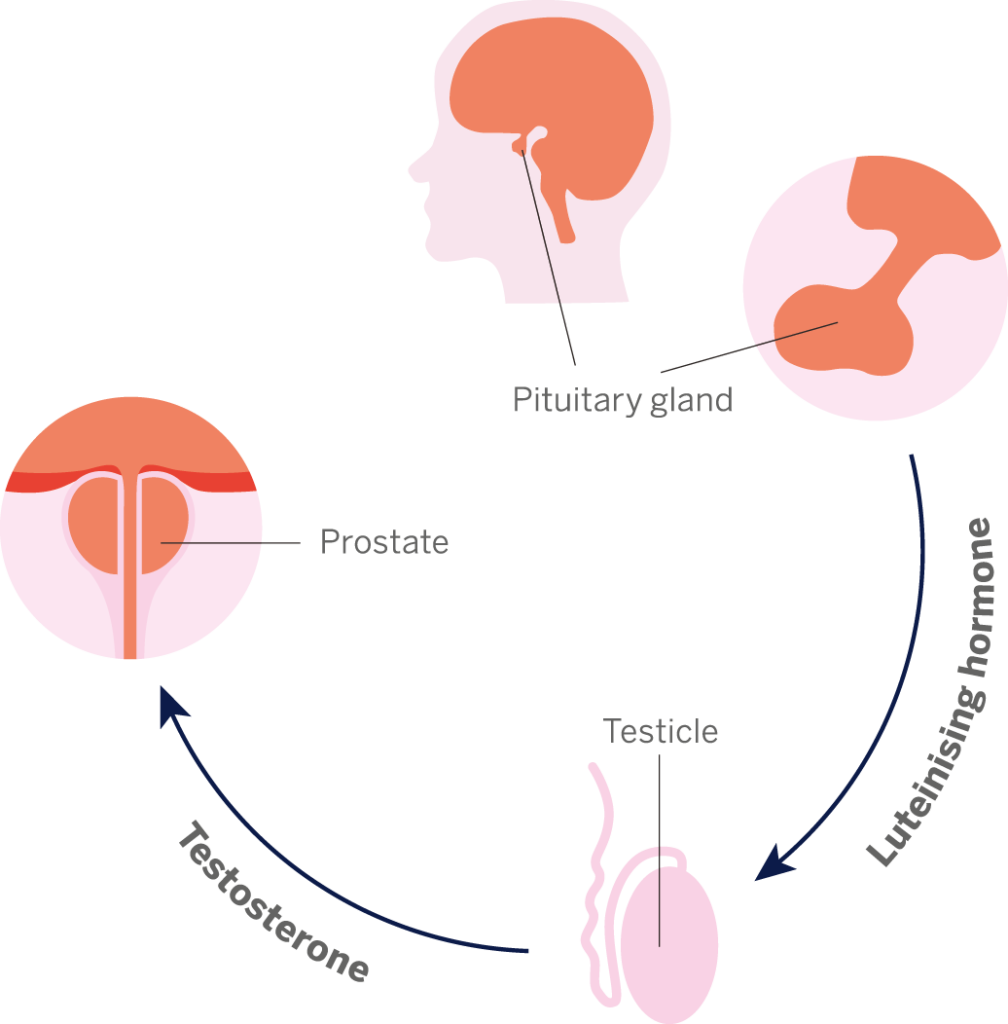 Hormone therapy Prostate Cancer Research