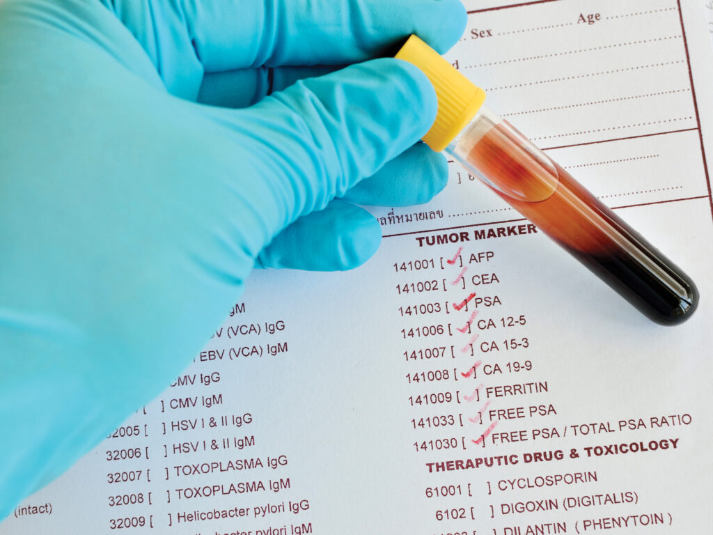Blood sample for tumor marker testing